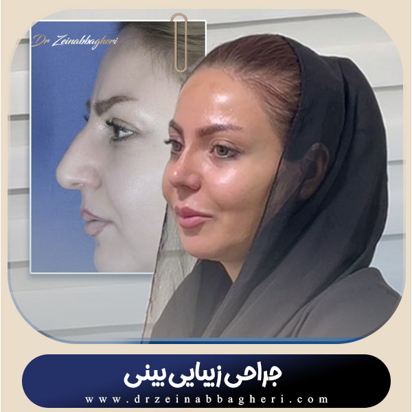 جراحی بینی در تهران + دکتر زینب باقری