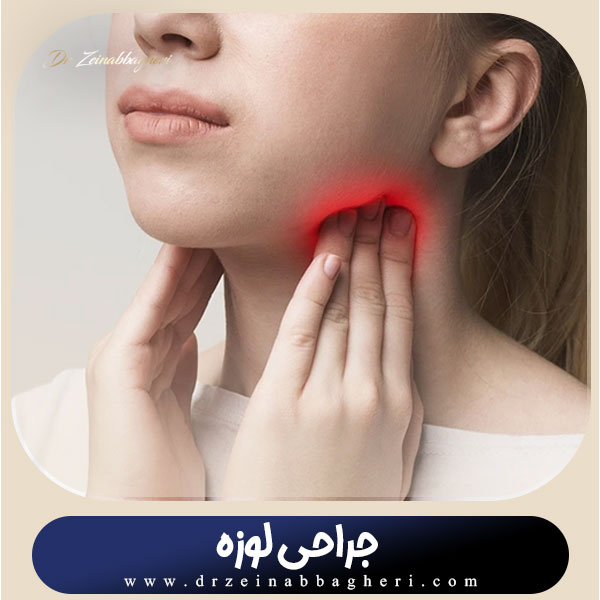 جراحی لوزه در تهران + دکتر زینب باقری