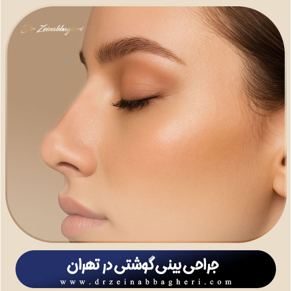 عمل بینی گوشتی در تهران + دکتر زینب باقری